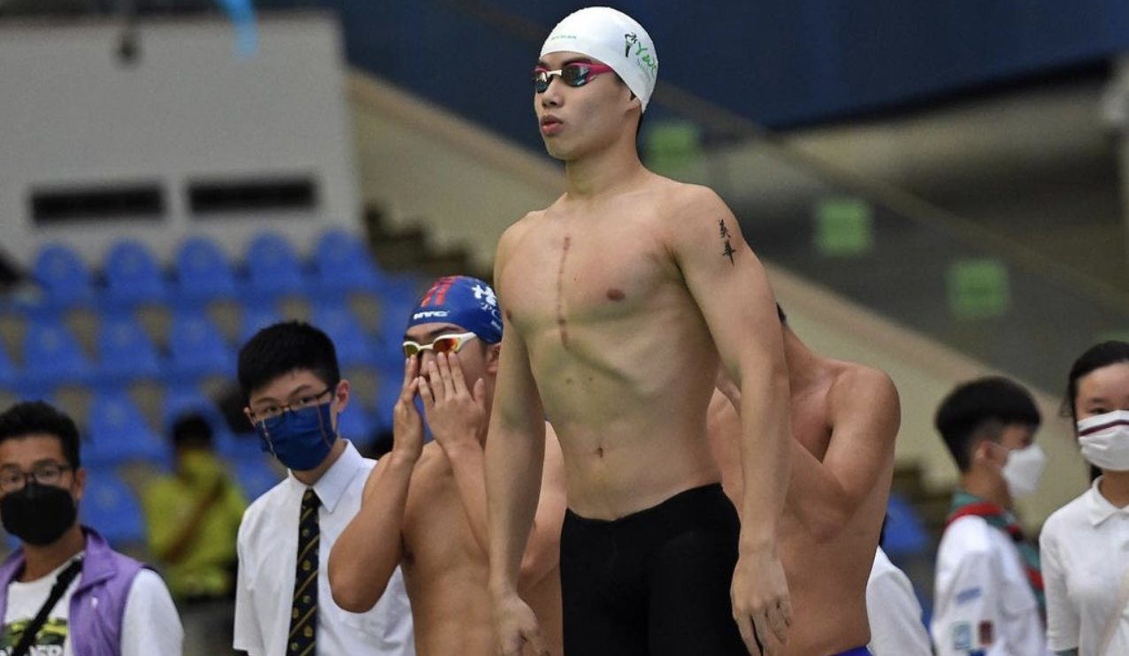 何肇倫術後胸口留下5吋長疤。