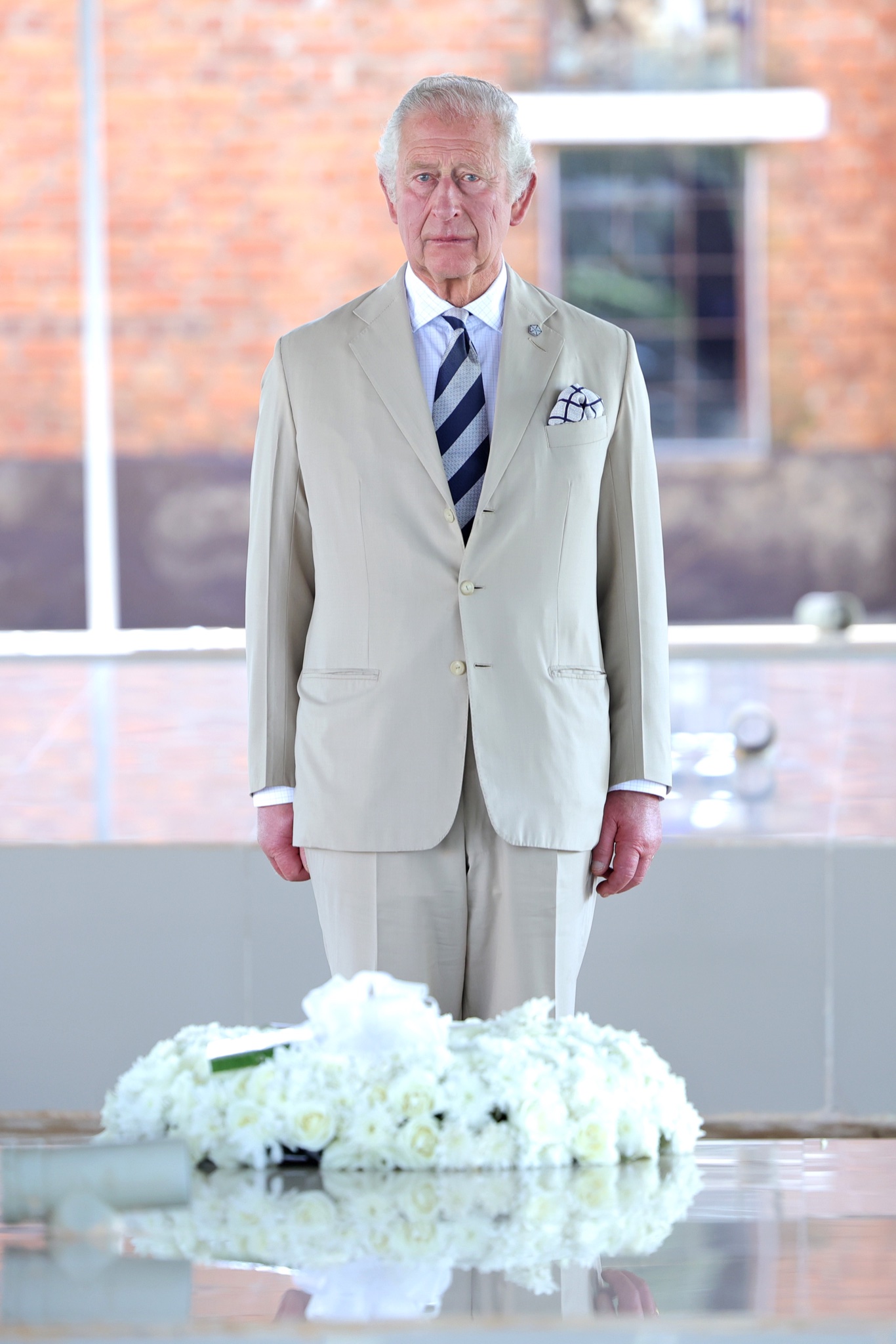 查理斯在多年前便已經有關節水腫問題，更自嘲是「香腸手指」。