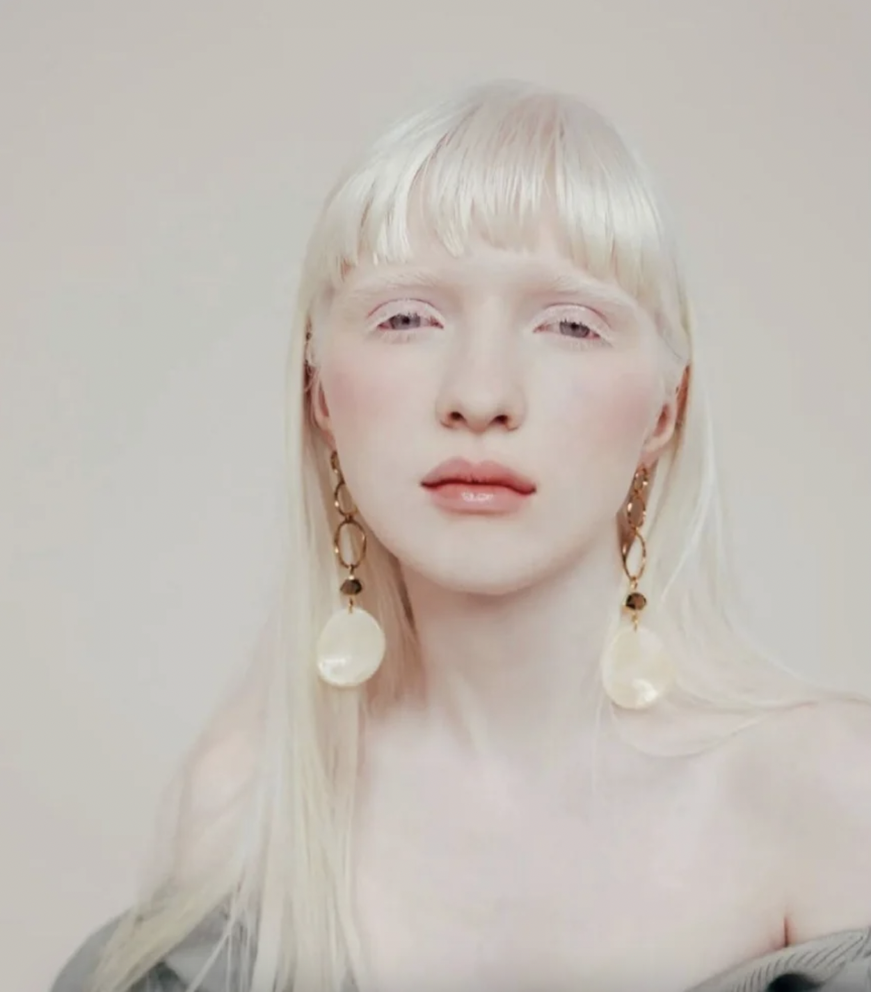 Nastya的頭髮、睫毛和眉毛也都是純白色。