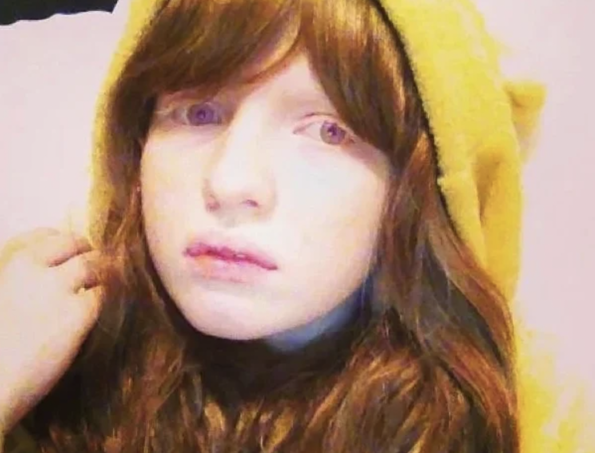 Nastya自小遭受同齡的小朋友排擠。