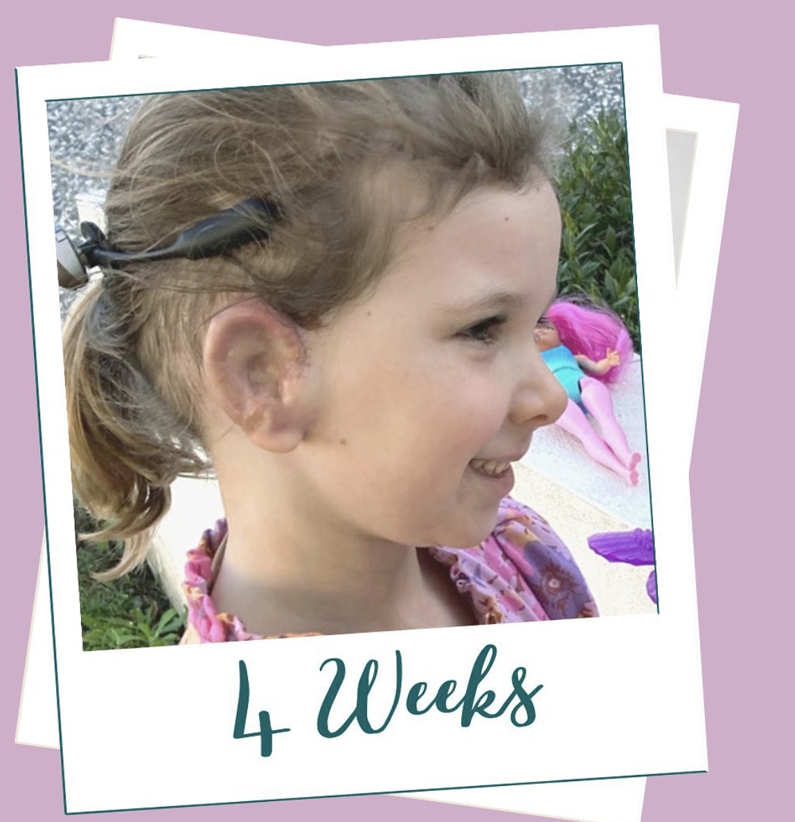 哈麗雅特康復得很好，並且沒有併發症。