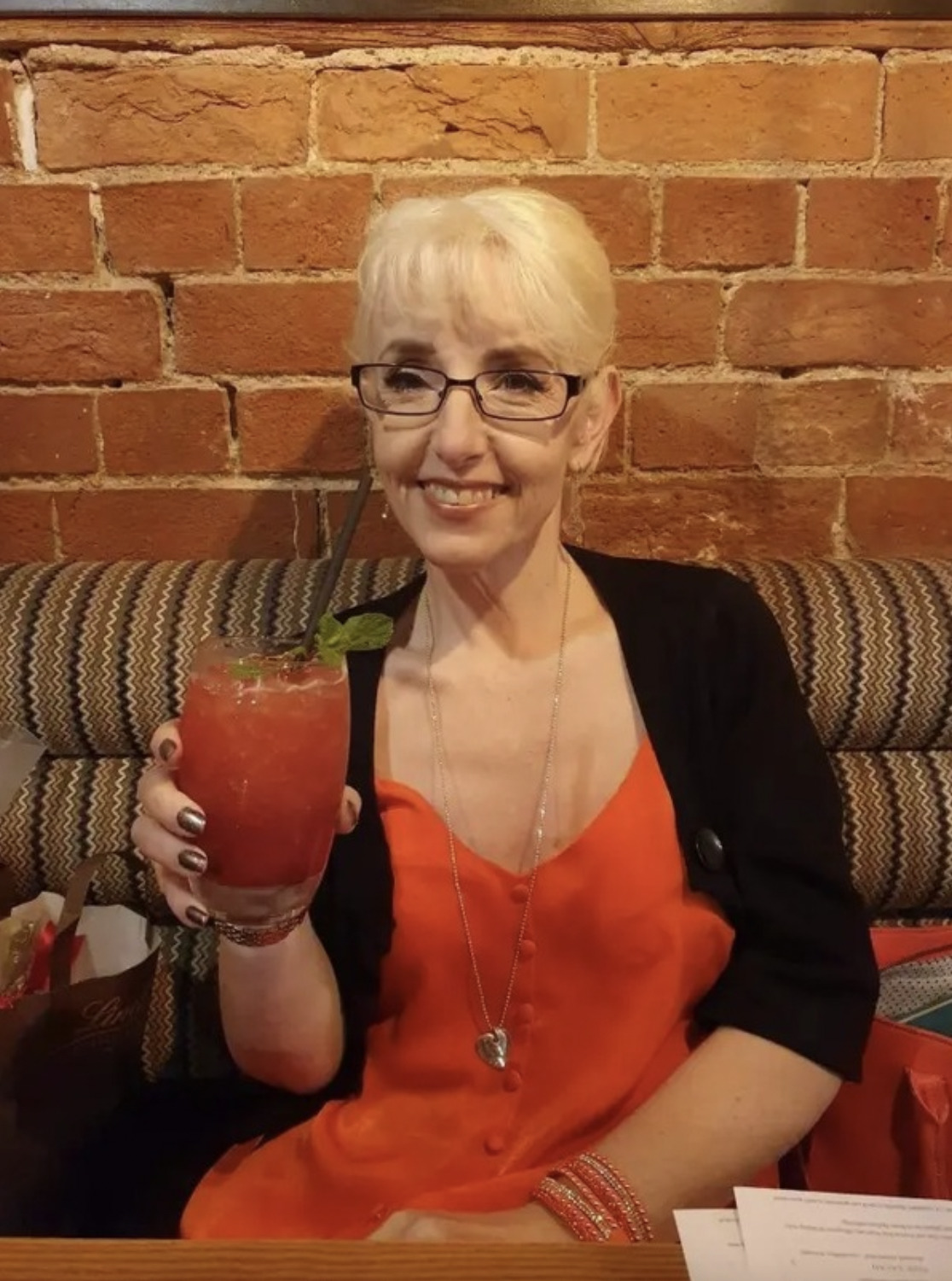 英國一名53歲女子減肥速度太快，導致皮膚嚴重鬆弛。