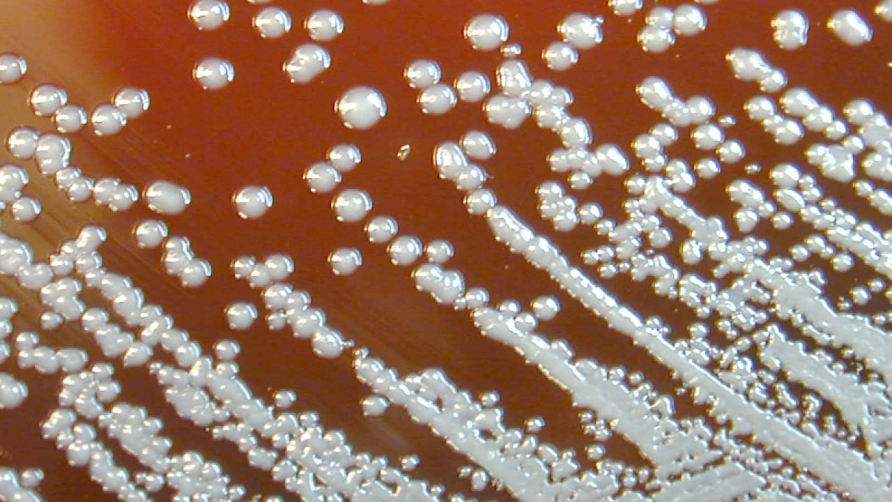 類鼻疽常見的病徵包括發燒、頭痛、局部痛楚或腫脹等。