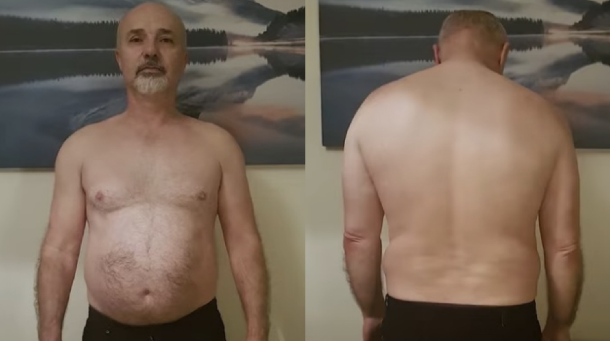 英國有一名60歲阿伯原本體重102公斤(約200磅),還患有糖尿病。