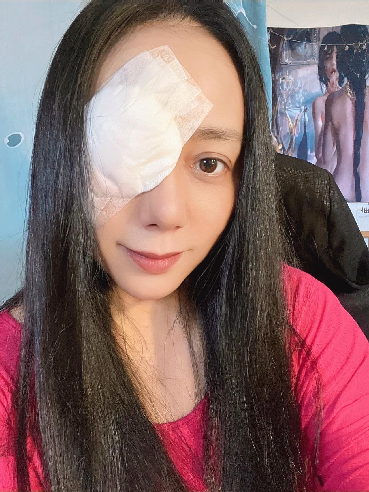台灣歌手高慧君去年10月驚爆眼睛出現一高一低,無法對焦的情況。