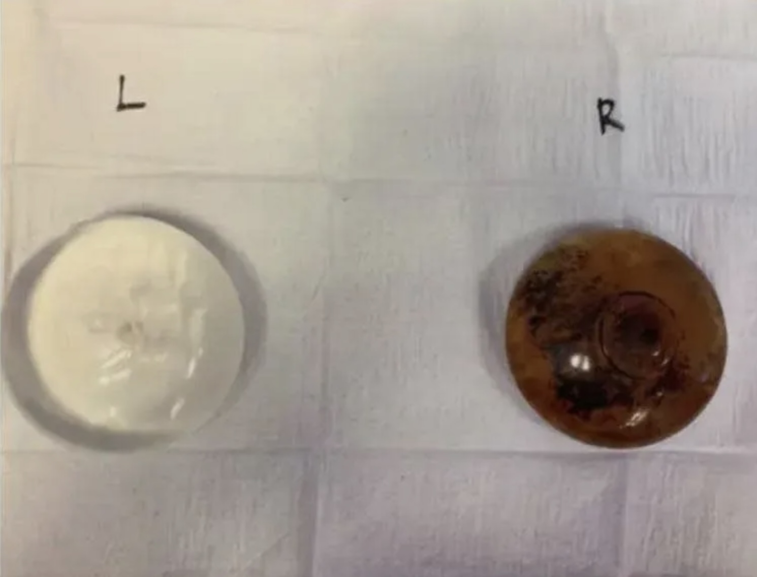 右邊的鹽水袋整個呈現深綠色，裏面還有許多黴菌漂浮物。