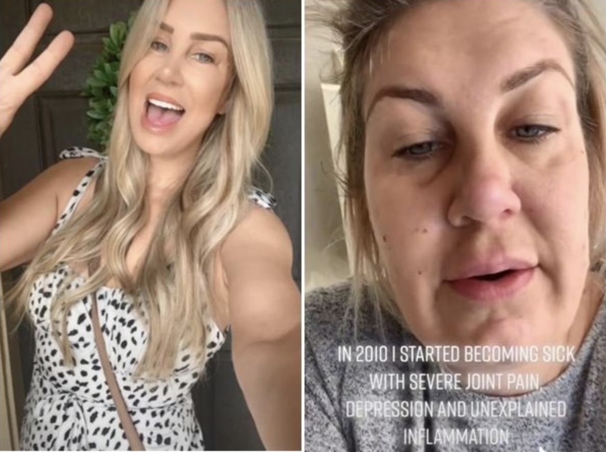 手術後的梅麗莎臉部和眼睛明顯消腫，身體也漸漸康復。