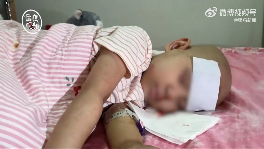 女童高燒不退,醫師起初診斷是病毒感染,但吃了藥卻不見好轉。