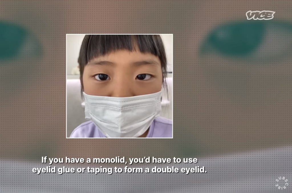 女兒米姬羨慕媽媽擁有一對雙眼皮大眼晴，也想割雙眼皮。