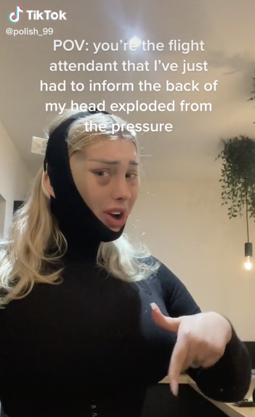 英國一名女網紅剛完成角膜整容手術即搭飛機,結果傷口在高空中爆炸。