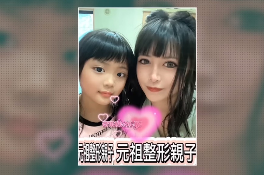 日本媽媽帶9歲女兒整容割雙眼皮。