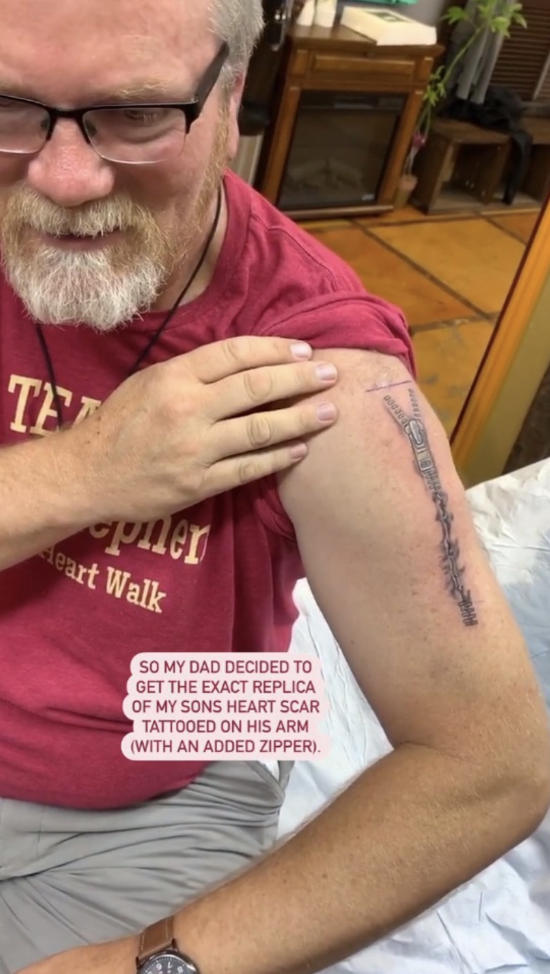 外公在手臂上紋上與疤痕相似的拉鍊圖案。