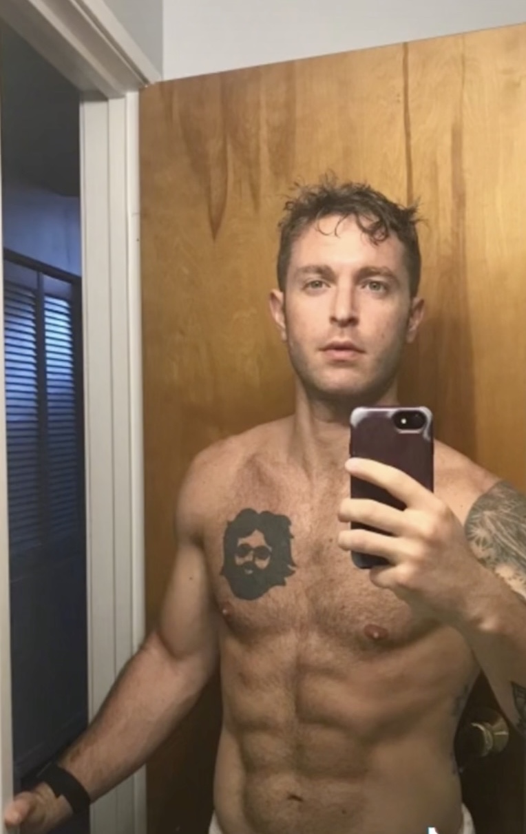 美國男子Matt Friend原本過著正常的生活,卻突然被診斷患有腦積水。