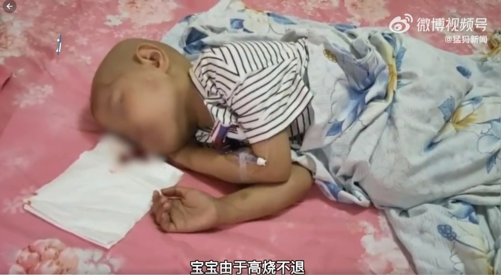 經檢查發現,萌萌的癌細胞已擴散至頭顱、骨髓及眼眶。