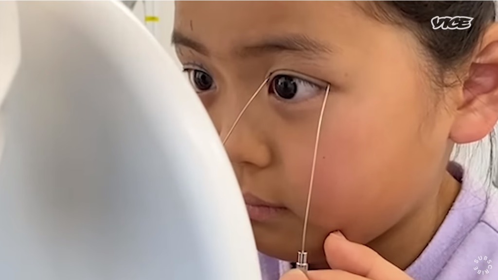 媽媽出錢讓女兒去割雙眼皮。