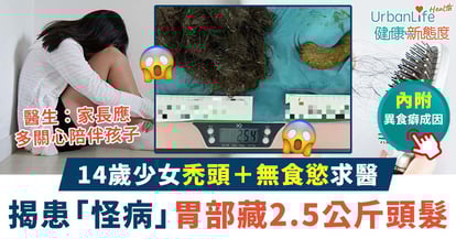 【異食癖成因】14歲少女禿頭+無食慾求醫 揭患「怪病」胃部藏2.5公斤頭髮