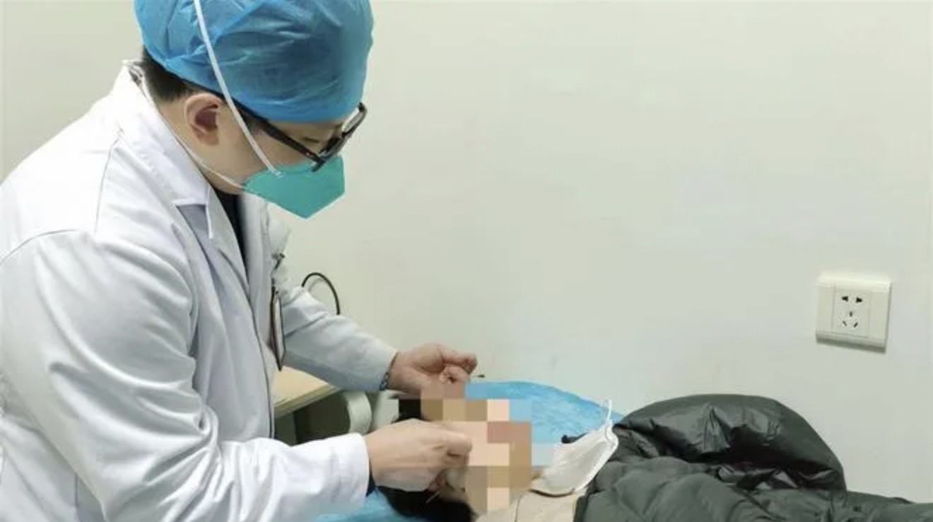 中國武漢市一名26歲曹姓男子熬夜看球後,被冷風一吹變面癱。