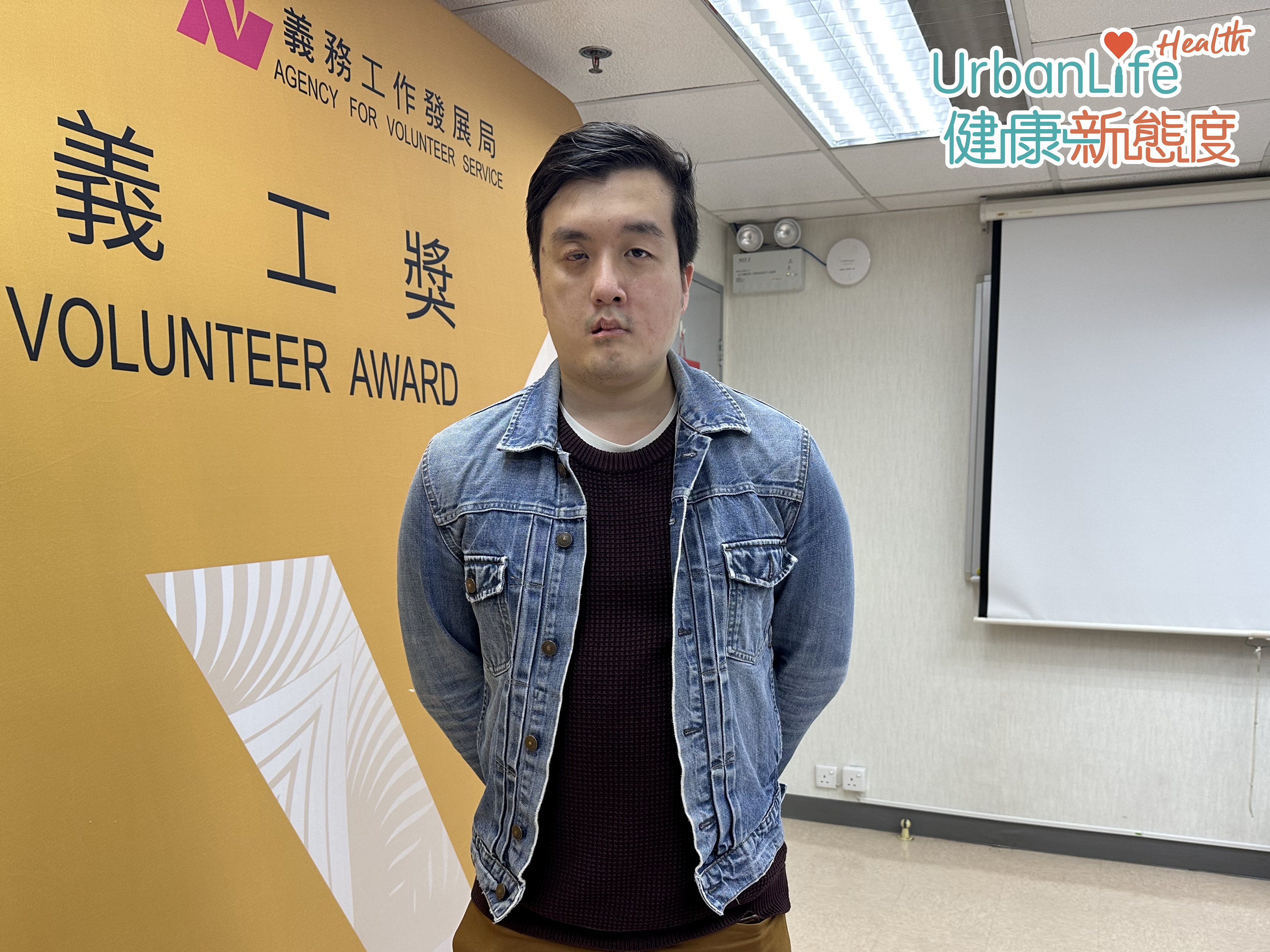 Michael因患腦癌而導致右邊面面癱。