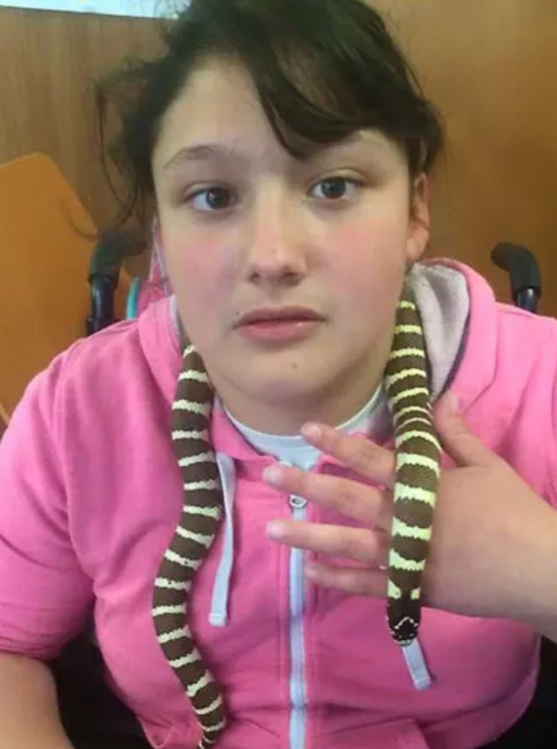 英國16歲少女凱莉亞(Kaylea Titford)患有罕見先天疾病「脊柱裂」(Spina Bifida)。