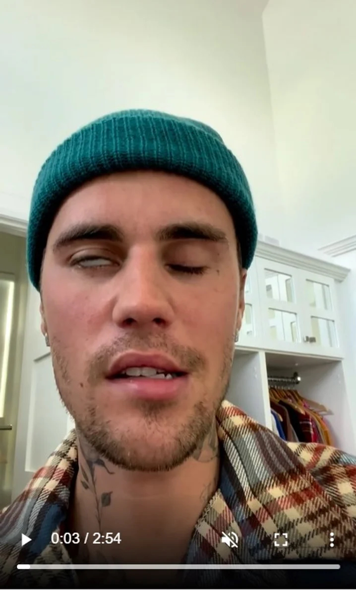  Justin Bieber今年6月在社交媒體上載的片段可見，他無法好好控制自己的半邊面。