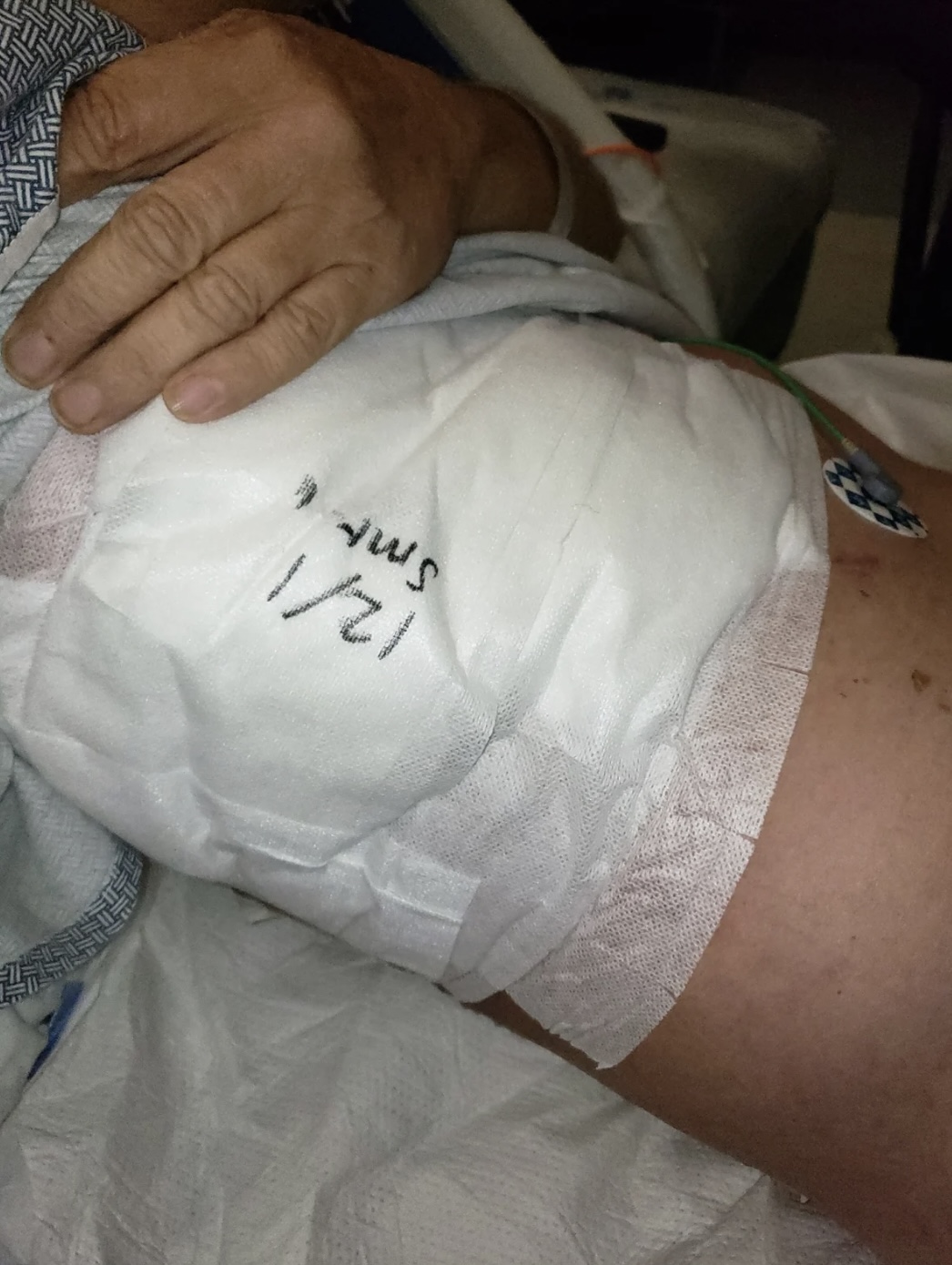 Nelson在萬聖節表演當天失手刺破內臟。