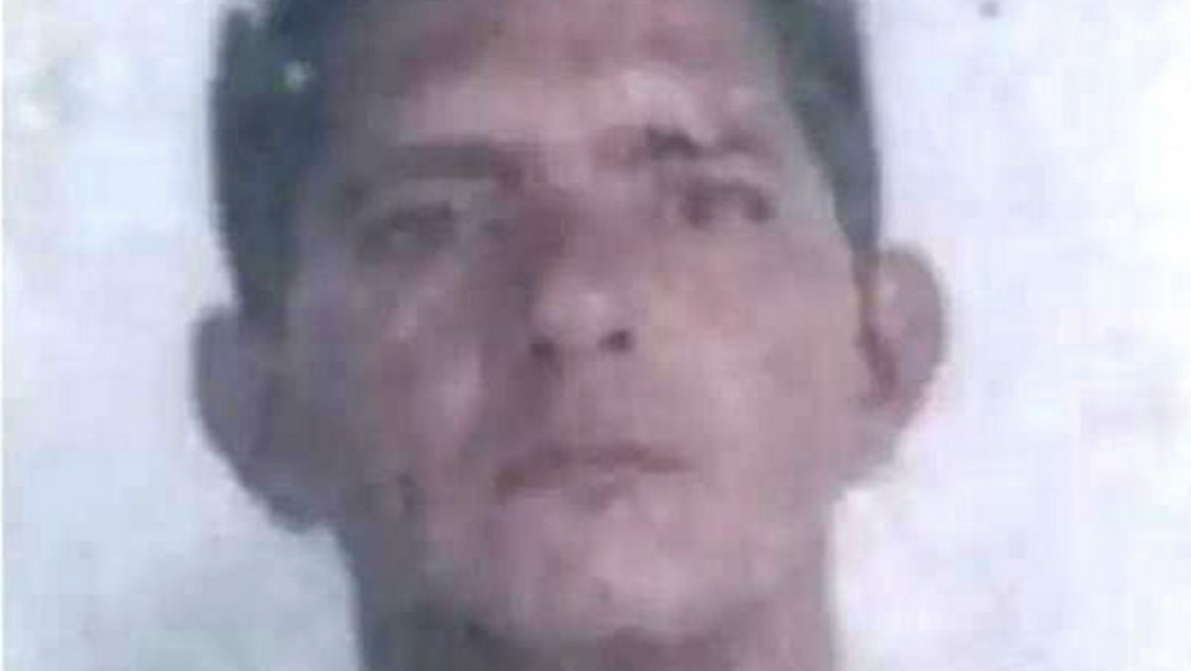62歲巴西男子達席爾瓦(Jose Ribeiro da Silva)患有口腔癌。
