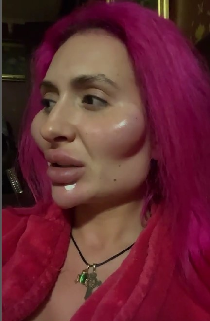 素顔照的她更明顯的顯露出臉上的植入的填充物與肉毒桿菌素的痕跡。