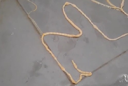 排出將近2米長的寄生蟲。