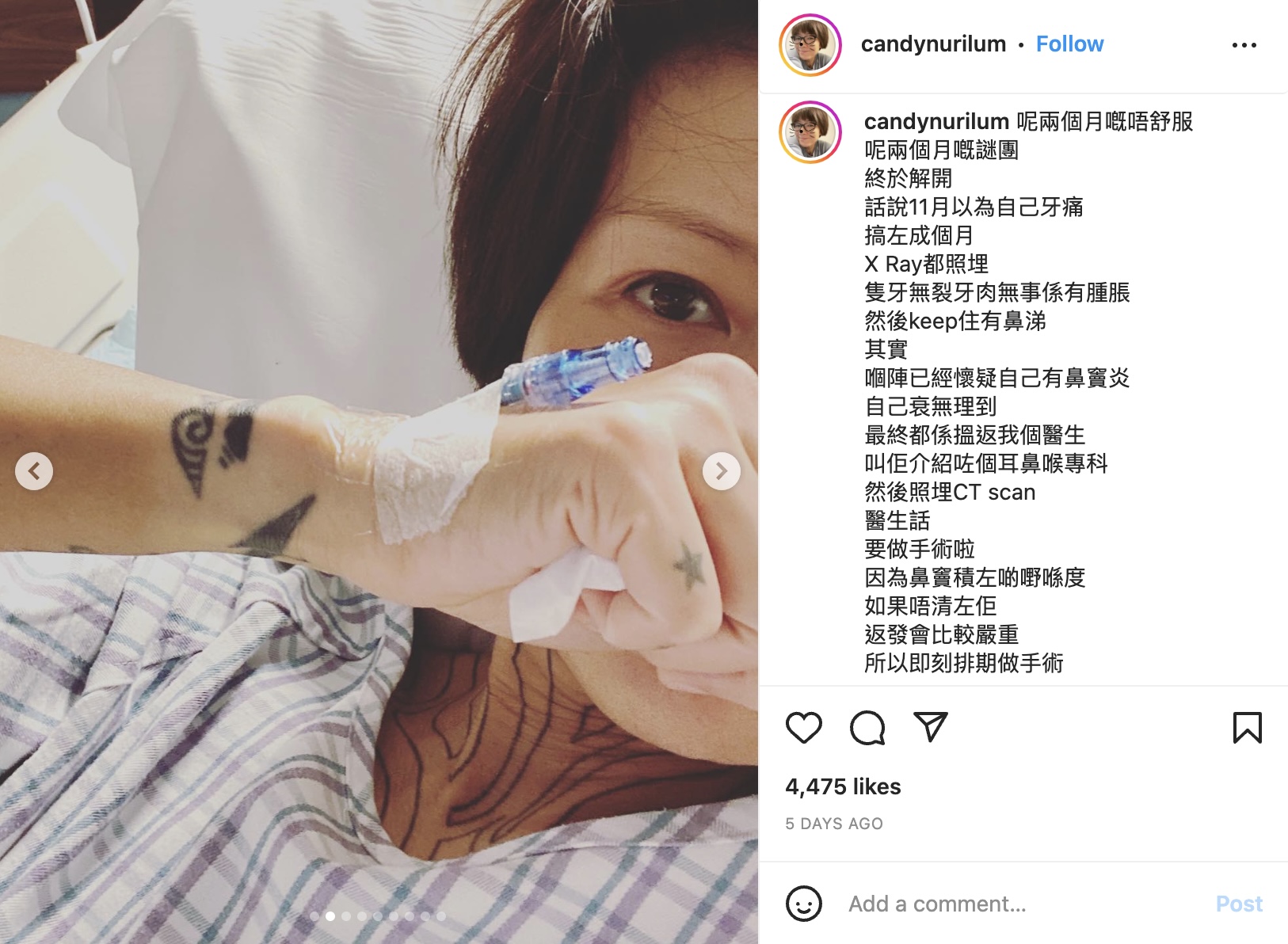 盧巧音患上鼻竇炎,情況嚴重得需要入院做手術。