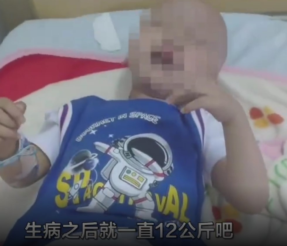 化療帶來的痛苦讓男孩的性情反覆無常,也因此而瘦了很多。