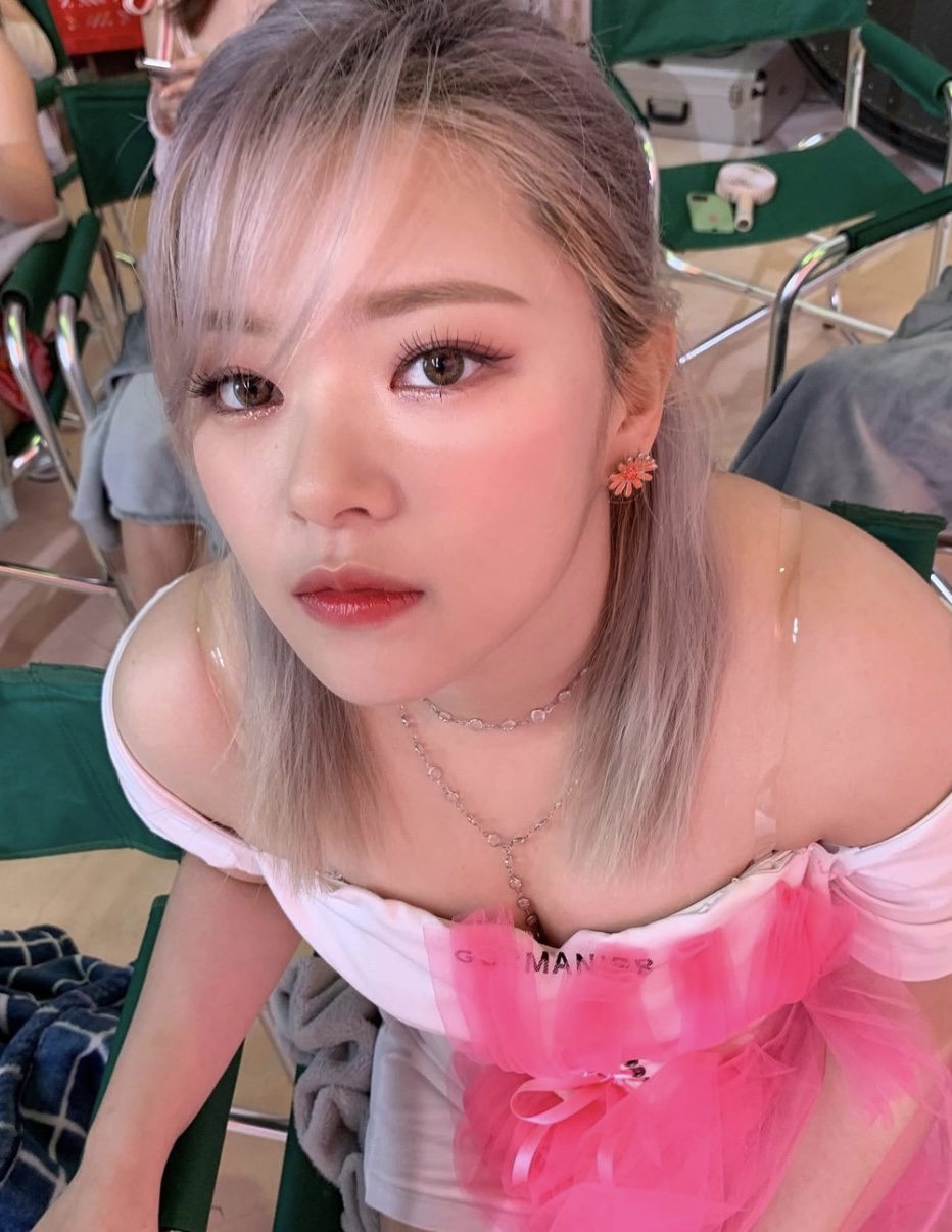 因長期服用類固醇導致肥胖。