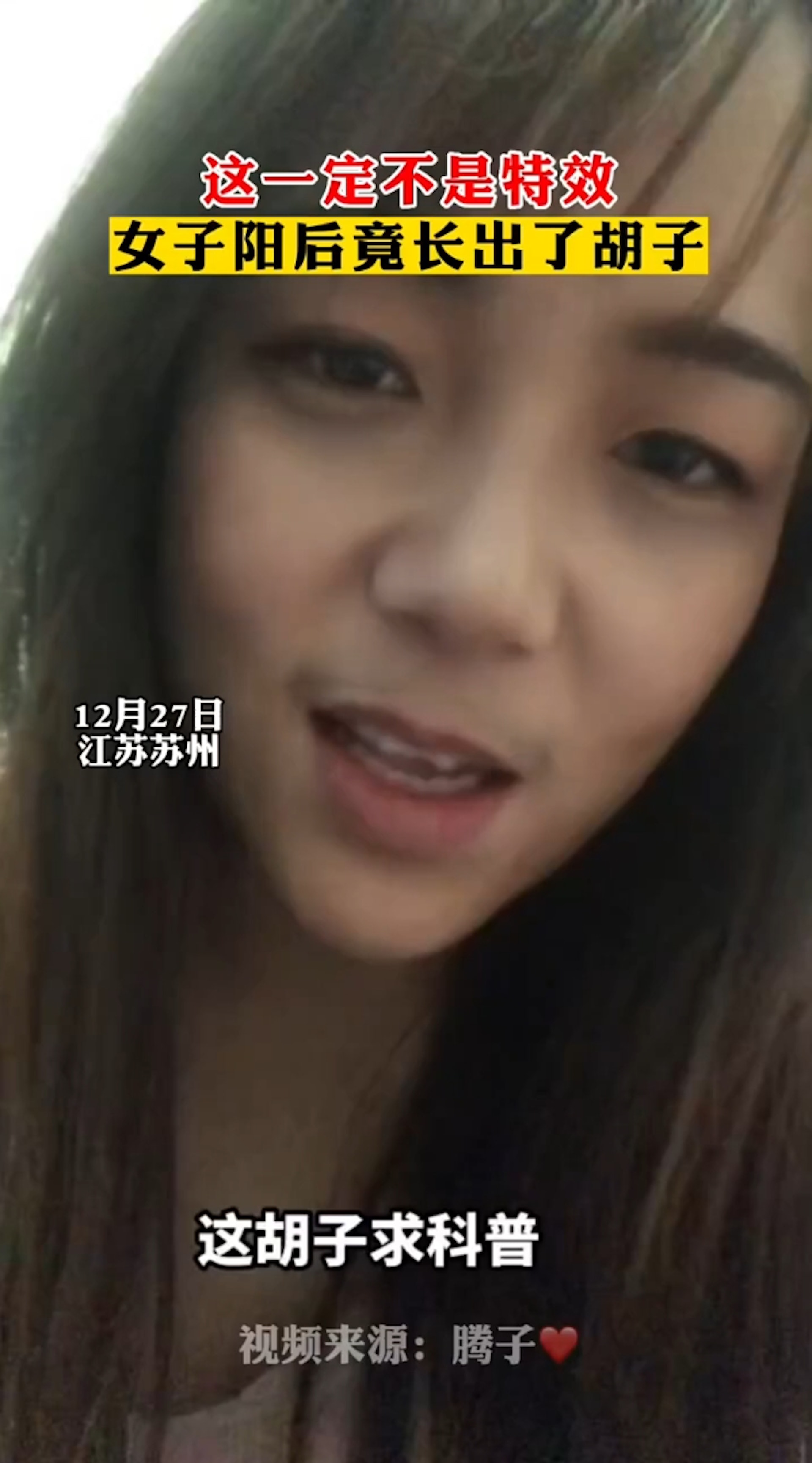 內地江蘇一名年輕女子染疫後竟長出鬍子。