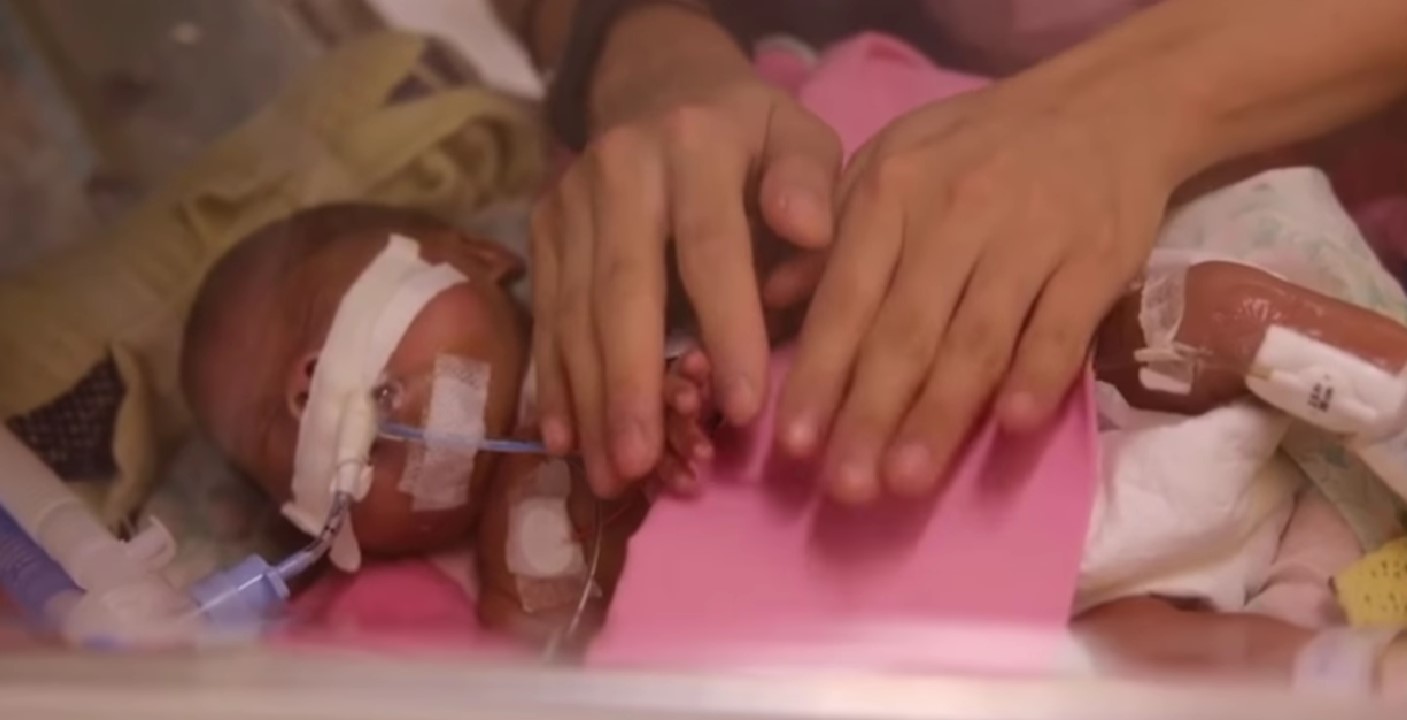 全身上下插滿喉管的心瀅，看得讓人痛心。