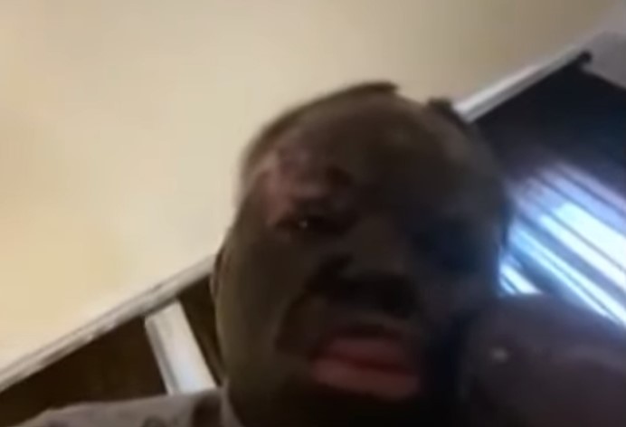 呼吸道仍因嚴重受損而導致無法説話,只能依靠打字與人溝通。