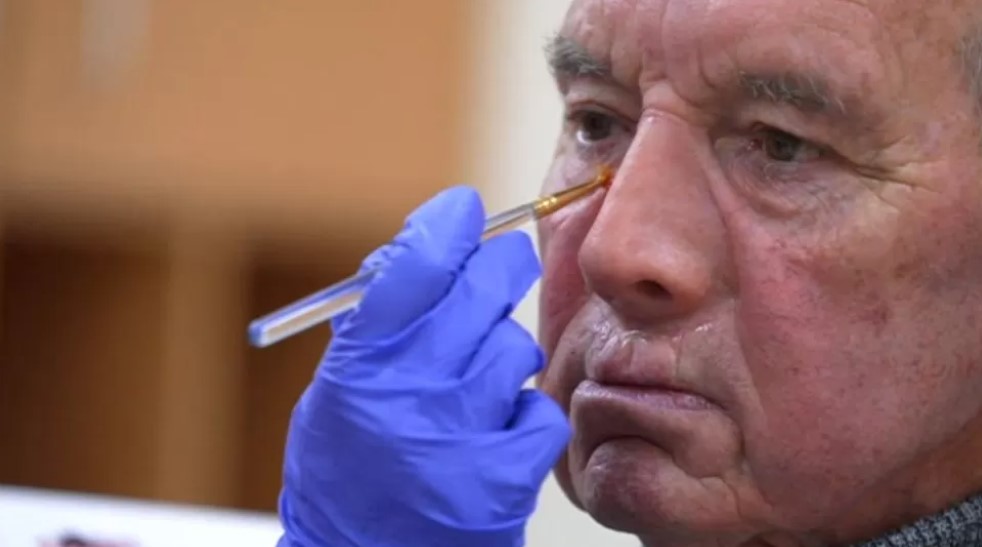 失去鼻子的患者。