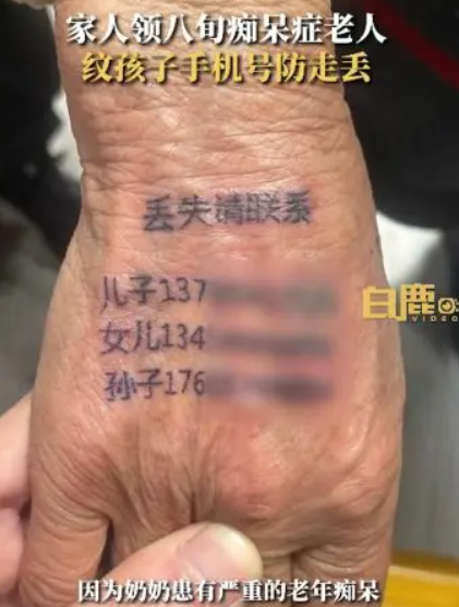 婆婆患有嚴重的腦退化症,孩子只好把家人的電話號碼紋在婆婆的手背上。