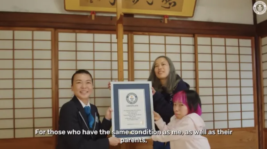 妹妹希望能藉由自己勵志的故事讓其他有身體缺陷的人重拾自信。