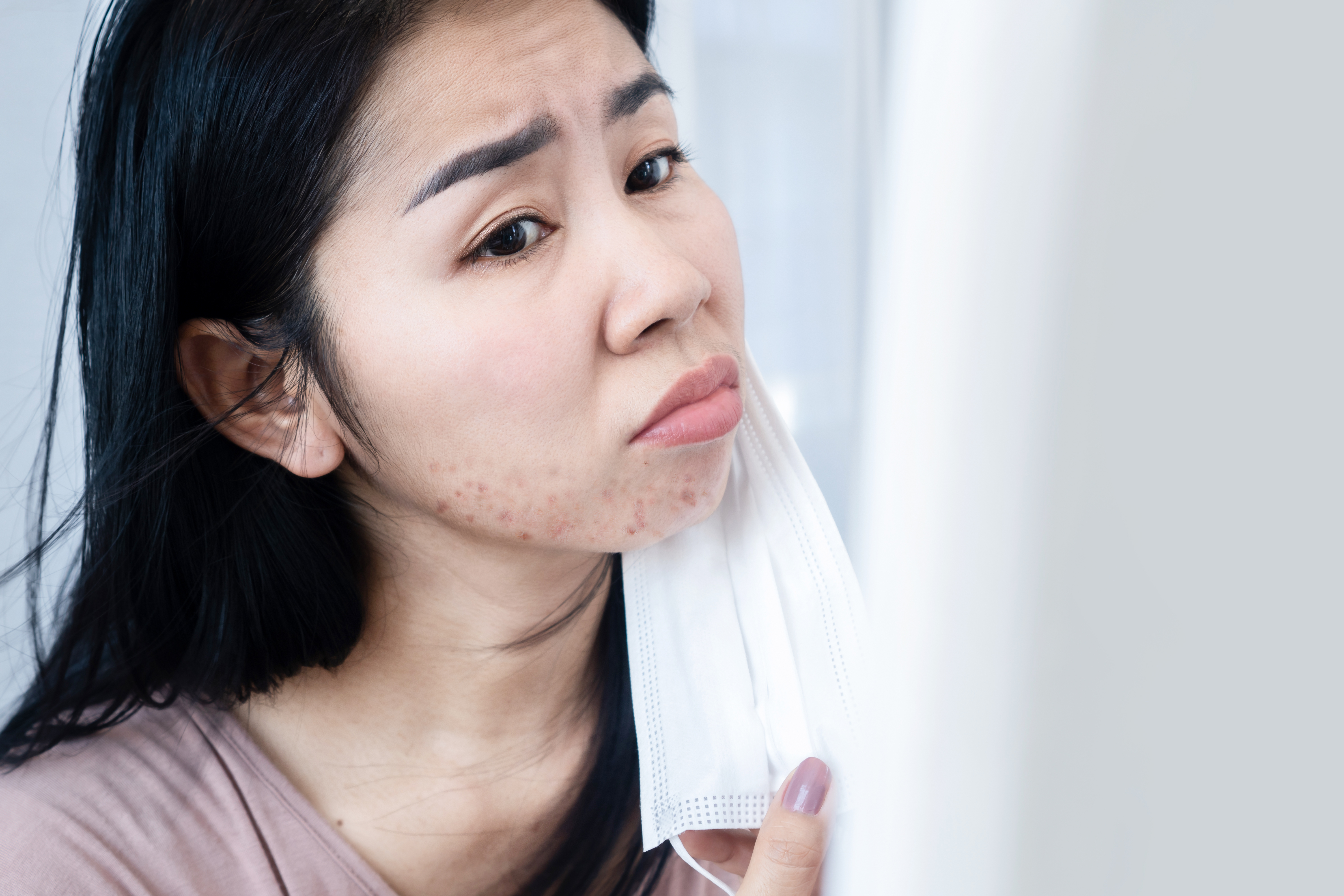 如果你對除罩後自己的面貌展露他人面前感到困擾,很大機會有「容貌焦慮」!