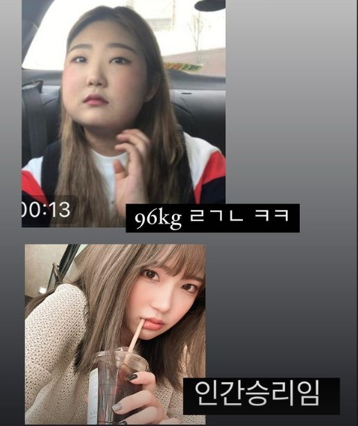 崔俊熙初中確診紅斑狼瘡症，因服用類固醇增磅。