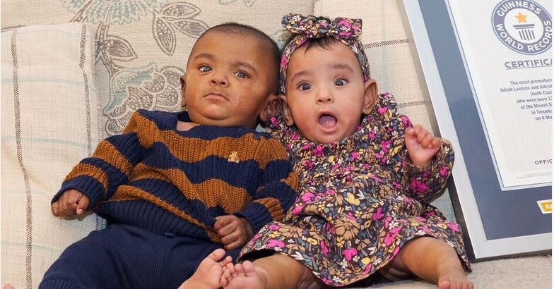 Adiah和Adrial獲健力士世界紀錄認證為全球最早產雙胞胎。