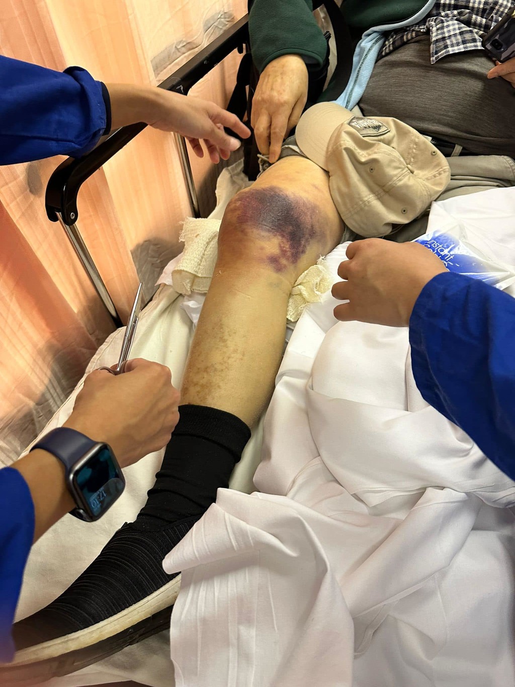 因為在第一次跌倒時已經傷及膝蓋，導致膝蓋已經無力支撐，所以後來一直在跌倒。