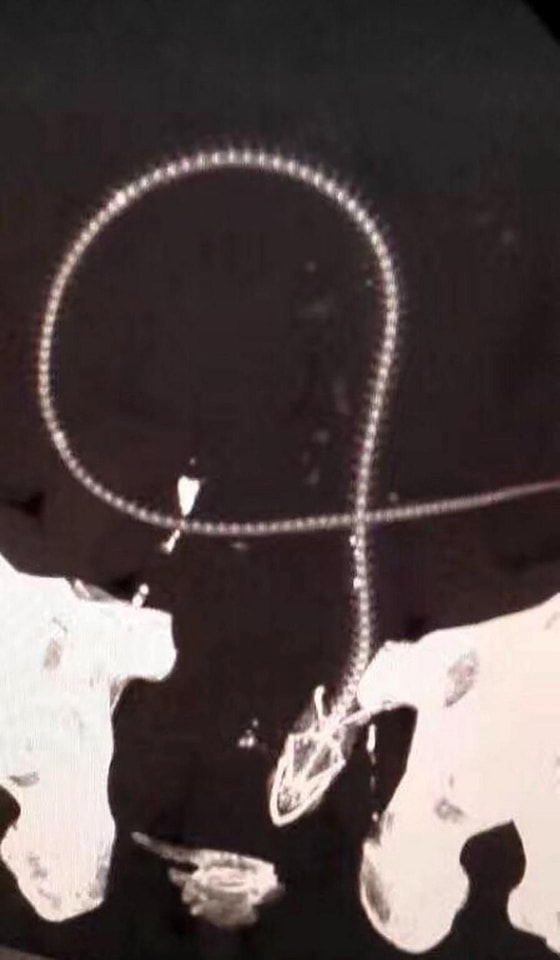 那條細長的鰻魚的魚骨頭在腹中繞成一圈。