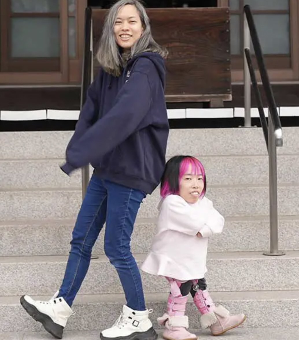 日本一對雙胞胎姊妹日前獲得健力士世界紀錄,認證為「身高差異最大的異卵雙胞胎」。