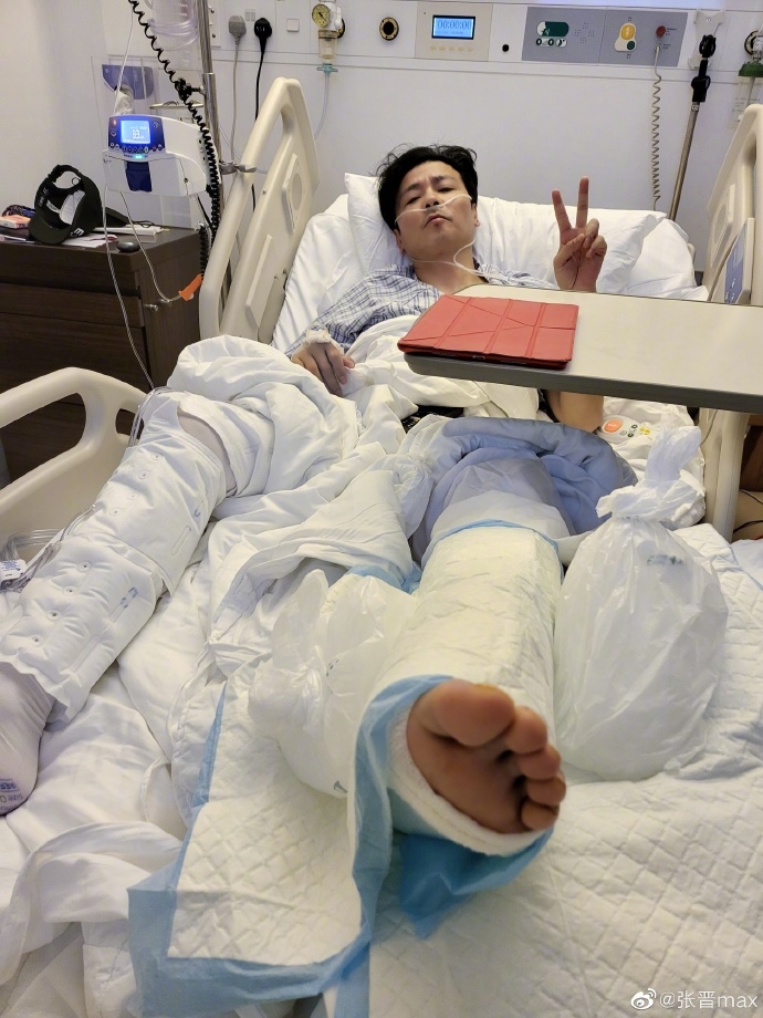 雖然張晉目前失去行動能力,但躺在病床上的他仍舉起V手勢,似乎想跟粉絲報平安,