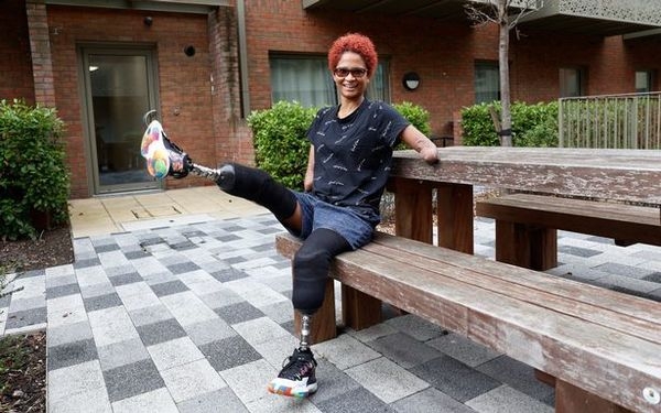 Timon並沒有因為失去四肢而失去了希望，反而是繼續保持積極與正面的心態。