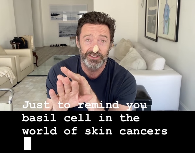 他在IG拍片提醒粉絲：一定要做好防曬！