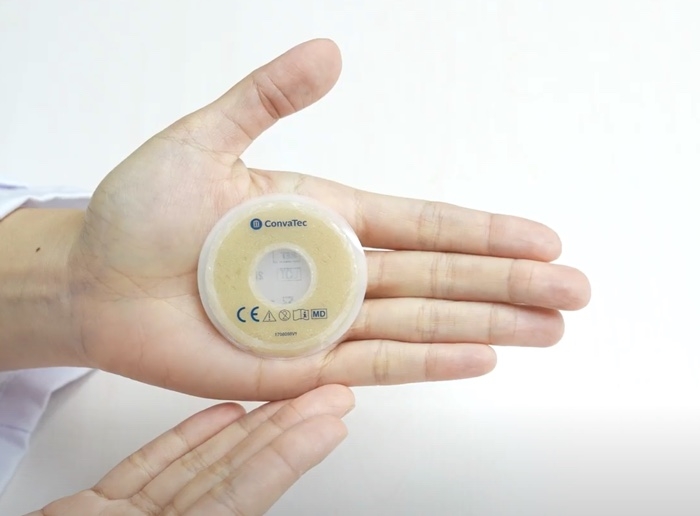 康復寶防漏密封環: 配合一件及兩件裝造口袋使用,能徒手按壓成合適的環狀及條狀,填補造口皺摺和皮膚凹陷位, 有效減少滲漏。