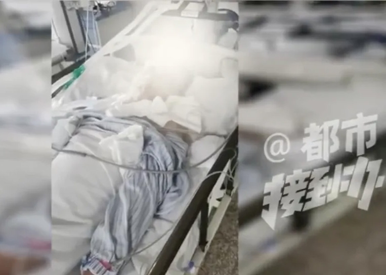 疑似因射釘槍的操作失誤,導致裡面的釘子瞬間射入腦袋裡面。