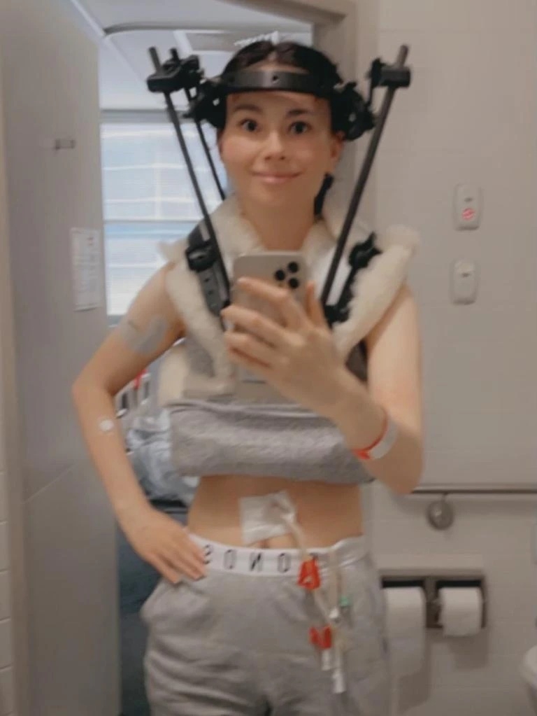 因病情惡化必須使用哈羅支架(Halo brace)固定頭部和頸部。