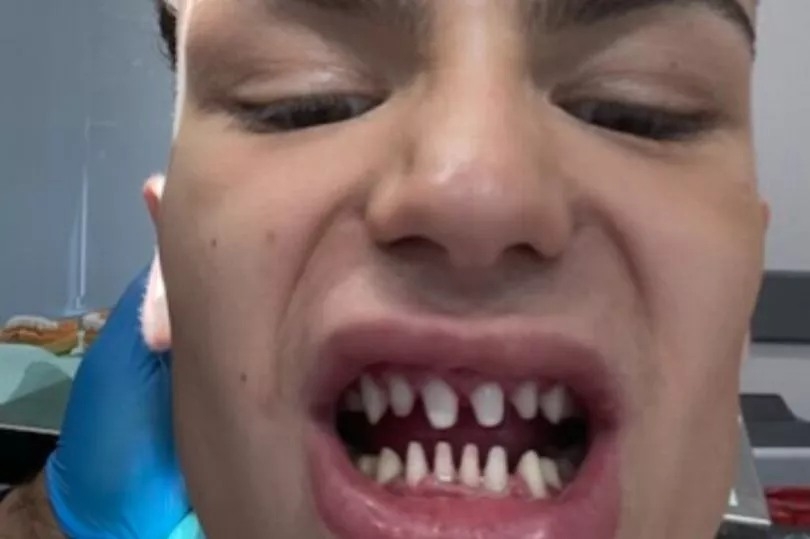 Jack表示「我現在看起來像一條鯊魚」，令他後悔莫及。